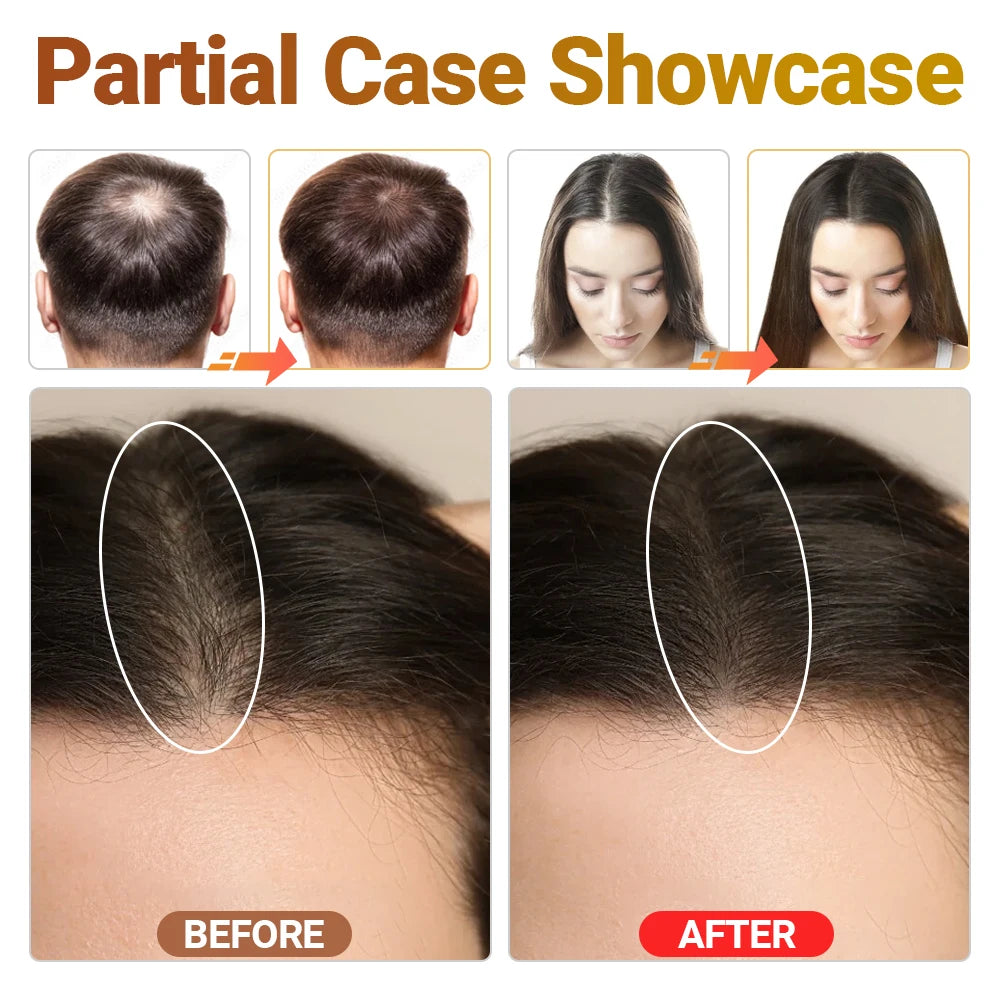 Tri-Chroma LLLT Laser Hair Therapy Device